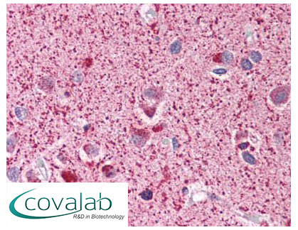 Merlin Immunohistochemistry