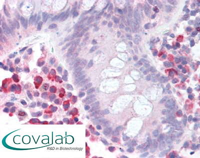 mTOR Immunohistochemistry