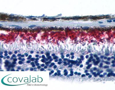 Rhodopsin Immunohistochemistry