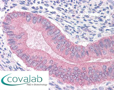 CTNNA1 Immunohistochemistry