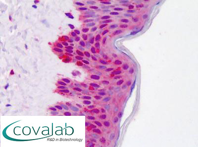 14-3-3 Beta Immunohistochemistry