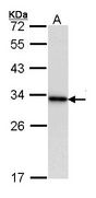 14-3-3 Beta Western Blot