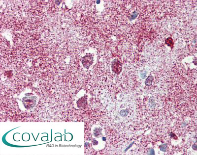 TAOK1 Immunohistochemistry