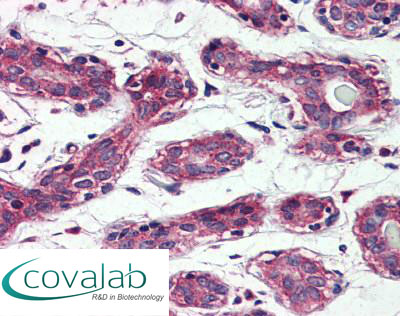 TAOK1 Immunohistochemistry