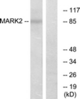 MARK2 Western Blot