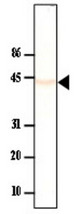 PPP2CA Western Blot