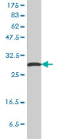 14-3-3 Sigma Western Blot