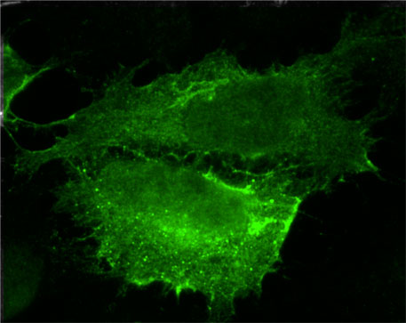 LATS1 Immunofluorescence