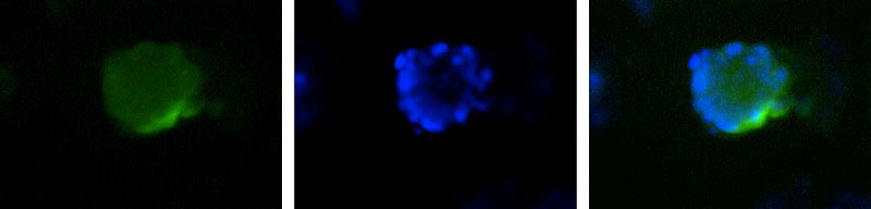 TAZ Immunofluorescence