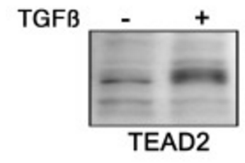 TEAD2 Immunofluorescence