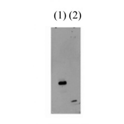 Ubiquitin antibody (10C2-2)