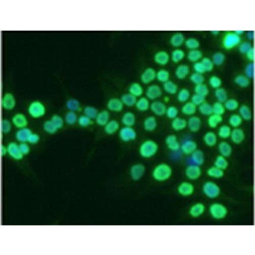 Nε-(ϒ-L-glutamyl)-L-lysine isopeptide antibody (81D1C2)