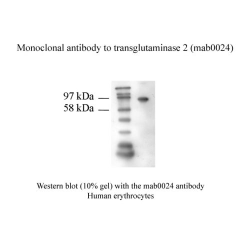 Transglutaminase-2 antibody (7D2)