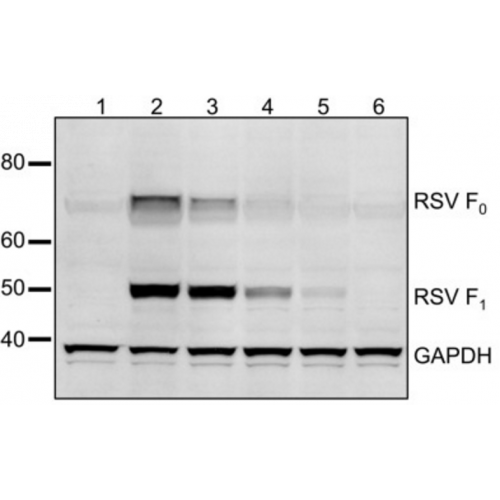 Respiratory Syncytial Virus (RSV) antibody (2F7)