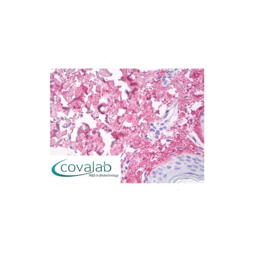 Collagen V alpha-1 chain N-propeptide -NC2 domain (COL5A1) antibody (18G5)
