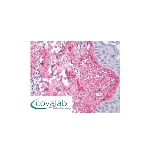 Collagen V alpha-1 chain N-propeptide -NC2 domain antibody (13F6)