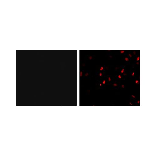 HA-Tag antibody (HA.C5 / C10)