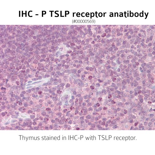 Anti-TSLP receptor antibody IHC staining of human thymus. Immunohistochemistry of formalin-fixed, paraffin-embedded tissue after heat-induced antigen retrieval. Antibody mab0076 concentration 10µg/ml.