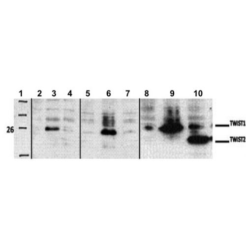 Twist-1 antibody (3E10)