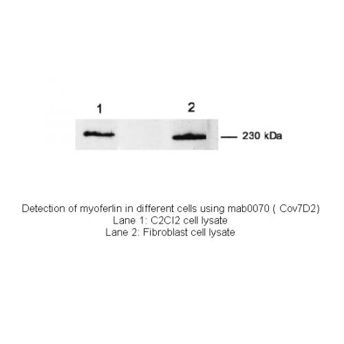 Myoferlin antibody (7D2)