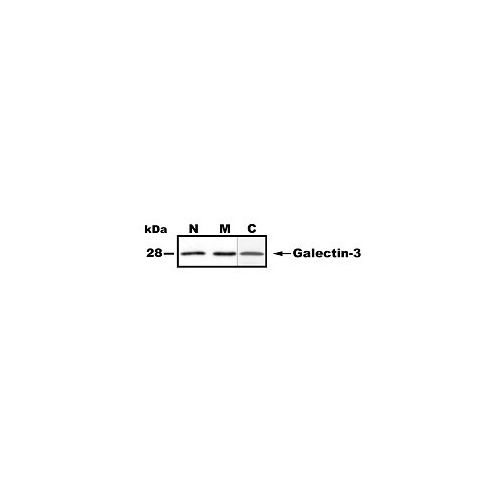 Galectin-3 antibody