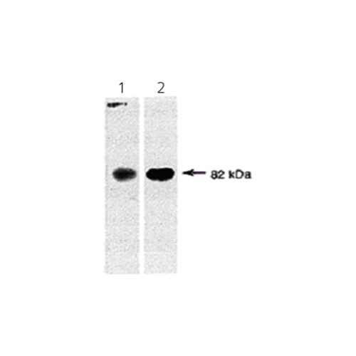 Transglutaminase-2 antibody