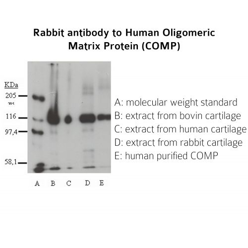 Cartilage oligomeric matrix protein antibody
