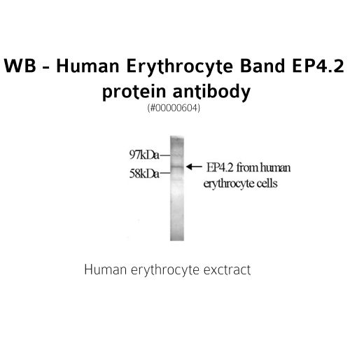 Erythrocyte Band EP4.2 protein antibody