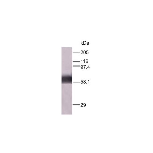 WB - Measles Nucleoprotein (NP) antibody<br/><br/>Anti-NP antibody WB staining of purified recombinant NP.