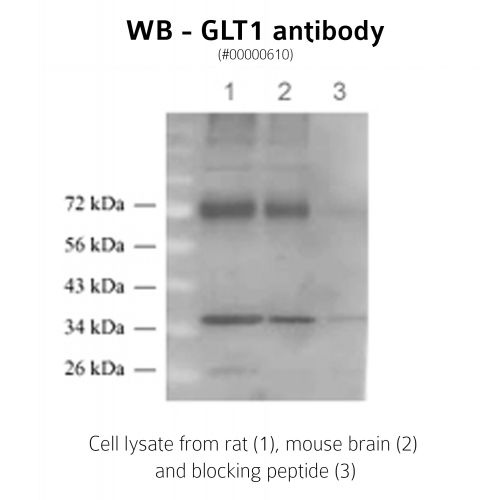 Excitatory amino acid transporter 2 antibody