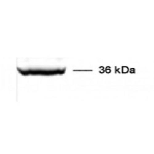 Cathepsin L protease [Mature-region] antibody