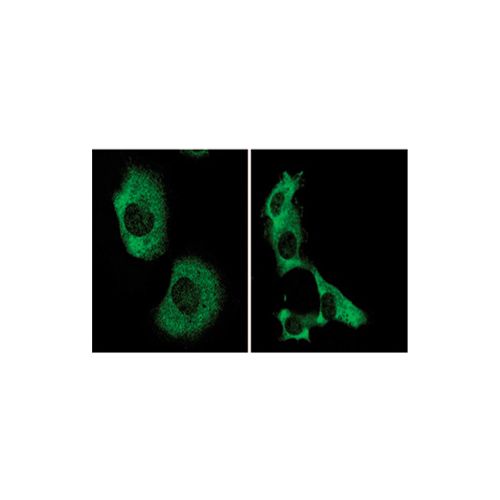 IF: Ambra1 antibody<br/>(pab0224)<br/>Anti-Ambra1 antibody IF staining of human fibroblasts expressing full length Ambra1.