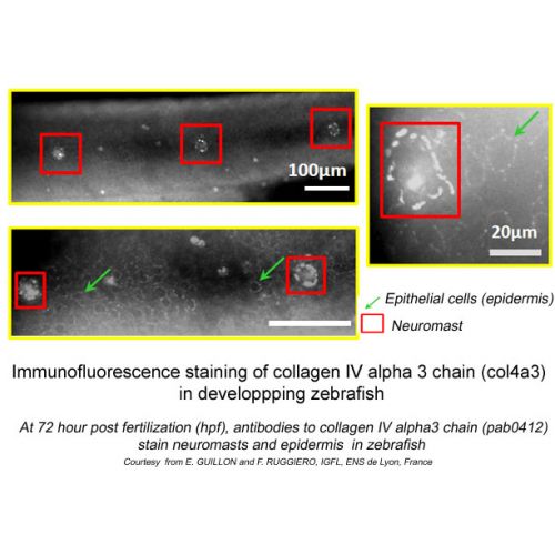 Collagen alpha-3 (IV) chain (COL4A3) antibody