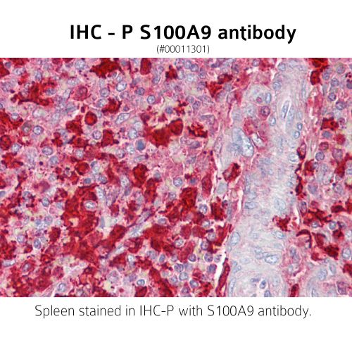 Protein S100-A9 antibody
