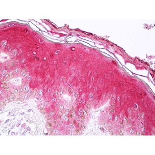 Caspase-14 antibody