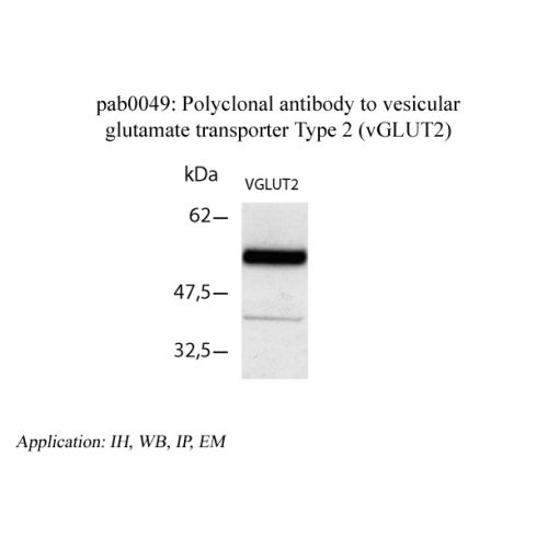 Vesicular Glutamate transporter type 2 antibody