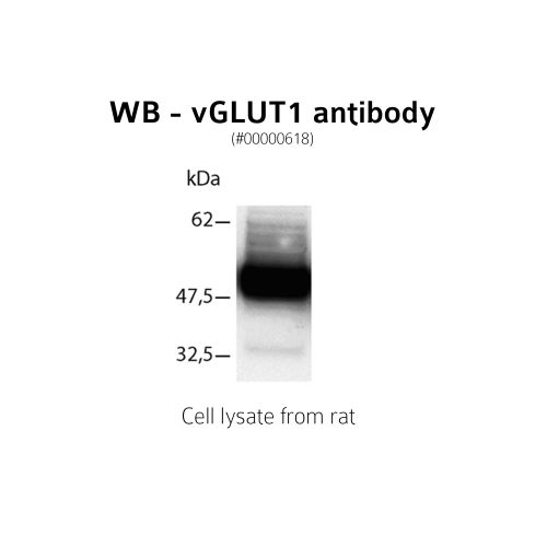 Vesicular Glutamate transporter type 1 antibody