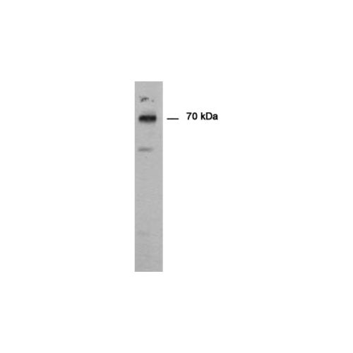 Protein-arginine deiminase type-1 (PADI1) antibody