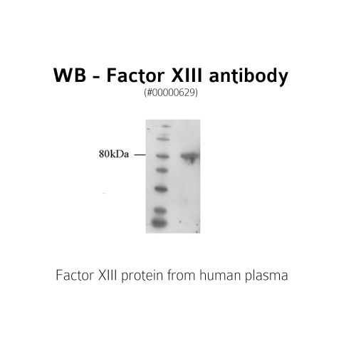 Plasmatic Transglutaminase 13 (FXIII) antibody