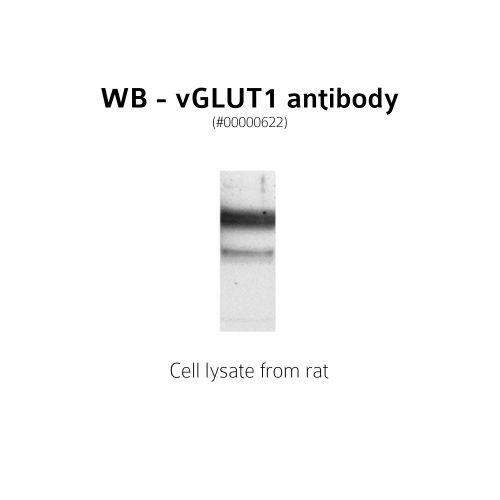 Vesicular Glutamate Transporter type 3 (VGluT3) antibody