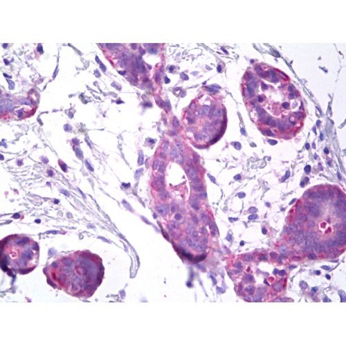 Transglutaminase-5 antibody