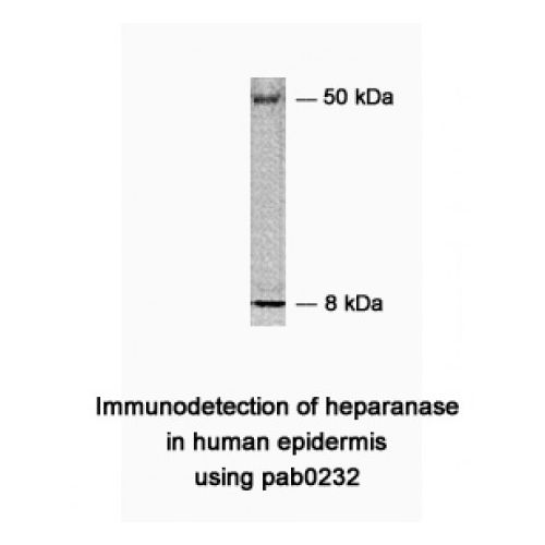 Heparanase (HPSE) antibody