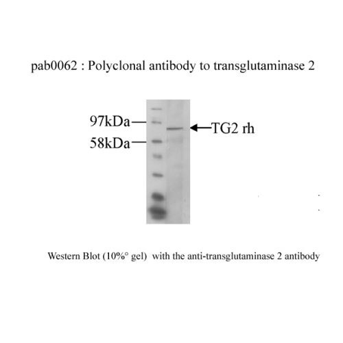 Transglutaminase-2 antibody