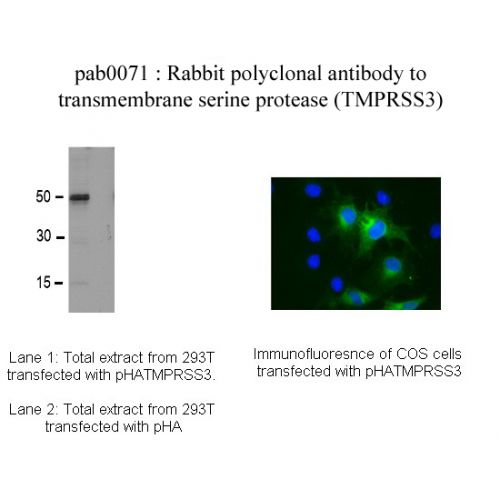 Transmembrane protease serine 3 antibody
