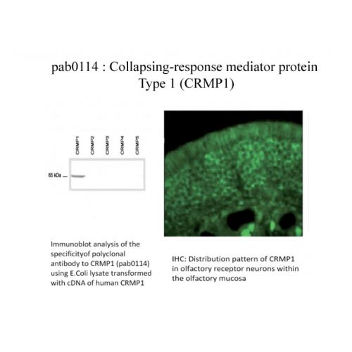CRMP-1 antibody