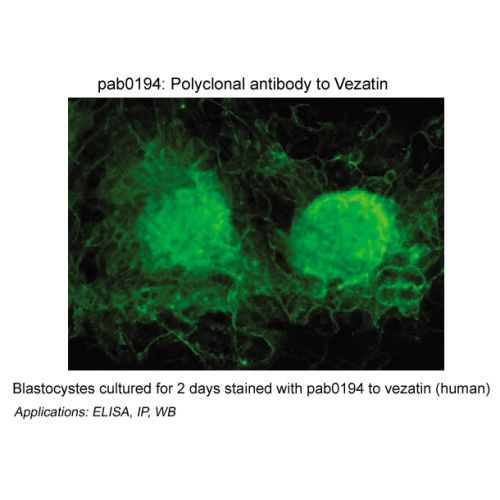 Vezatin antibody