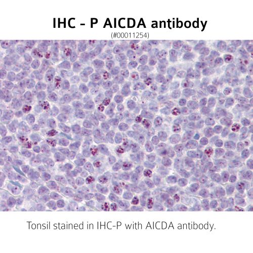 Activation-induced cytidine deaminase (AICDA) antibody