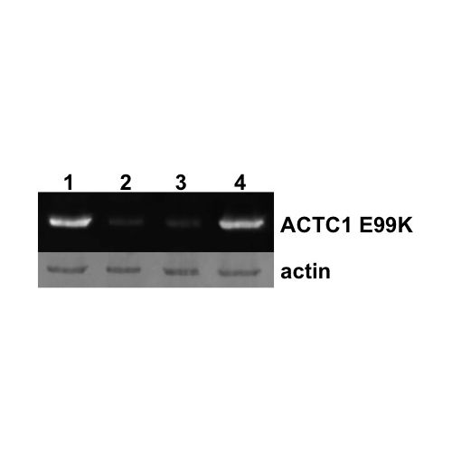 Actin, alpha cardiac muscle 1 E99K mutation antibody