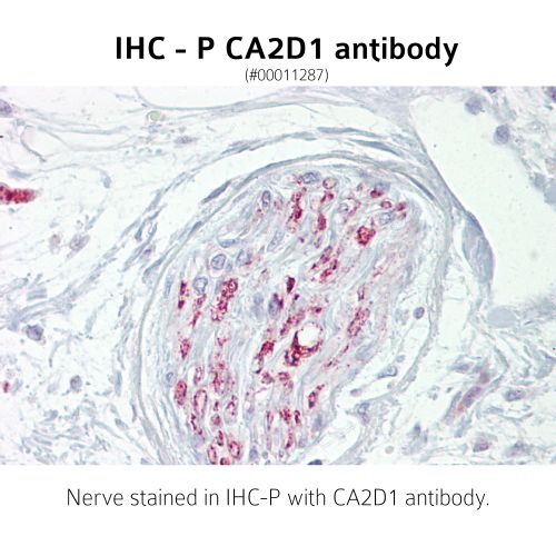 Voltage-dependent calcium channel subunit alpha-2/delta-1 (CA2D1) antibody