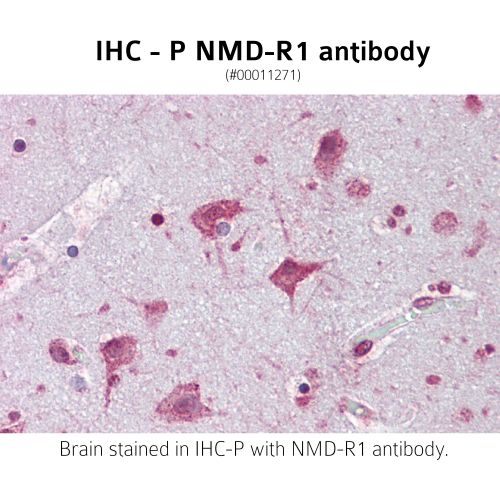 Glutamate [NMDA] receptor subunit zeta-1 precursor (NMD-R1) antibody